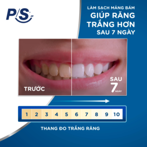 Kem Đánh Răng P/S Than Hoạt Tính Trắng Răng Tự Nhiên 230g